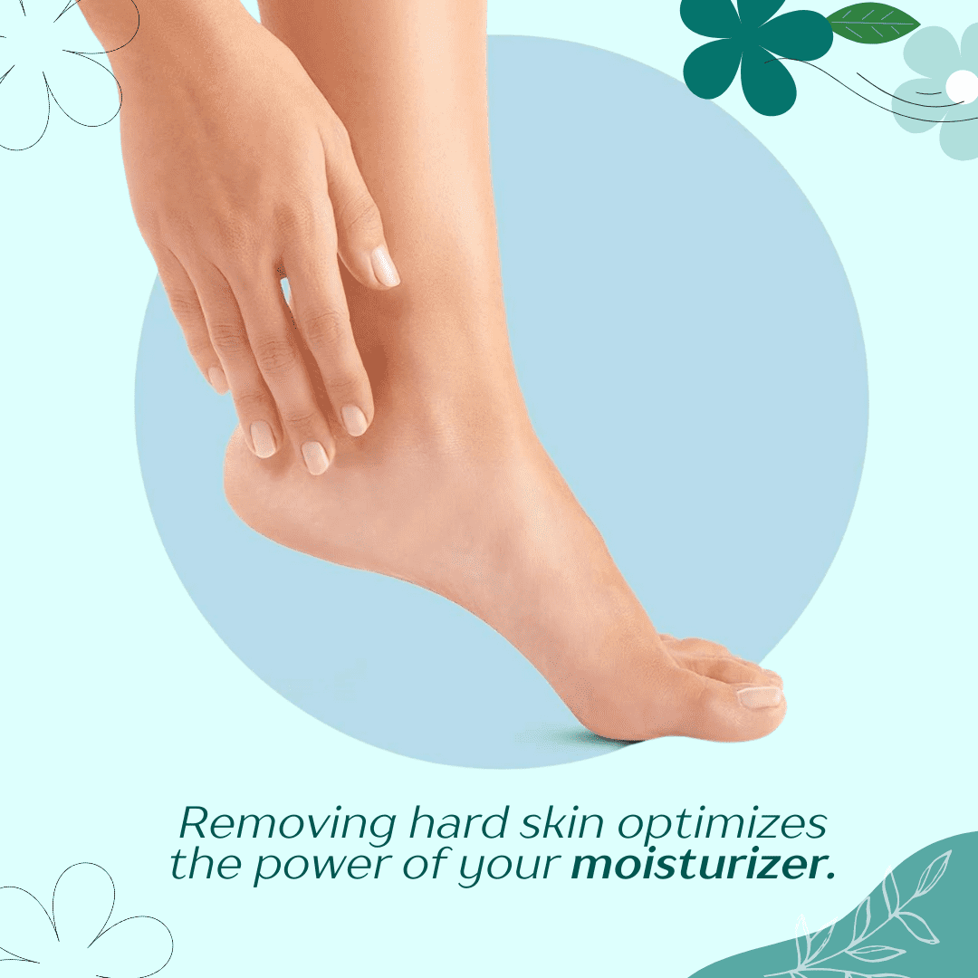 Electric Foot Filer & Callus Remover (Assorted Color) - Image 3