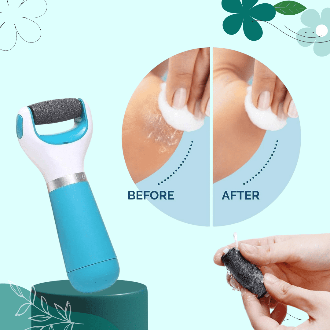 Electric Foot Filer & Callus Remover (Assorted Color)